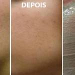 3 Receitas de Mascaras Caseira