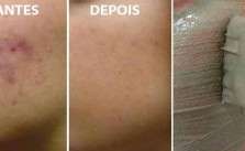 3 Receitas de Mascaras Caseira