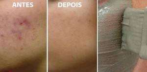 3 Receitas de Mascaras Caseira